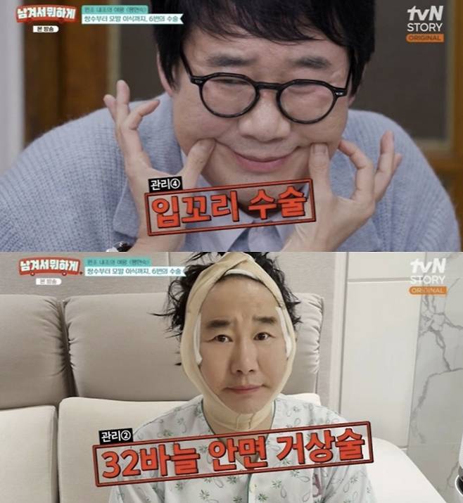 팽현숙 “최양락 안면거상·박피·모발이식·쌍커풀 시술해”