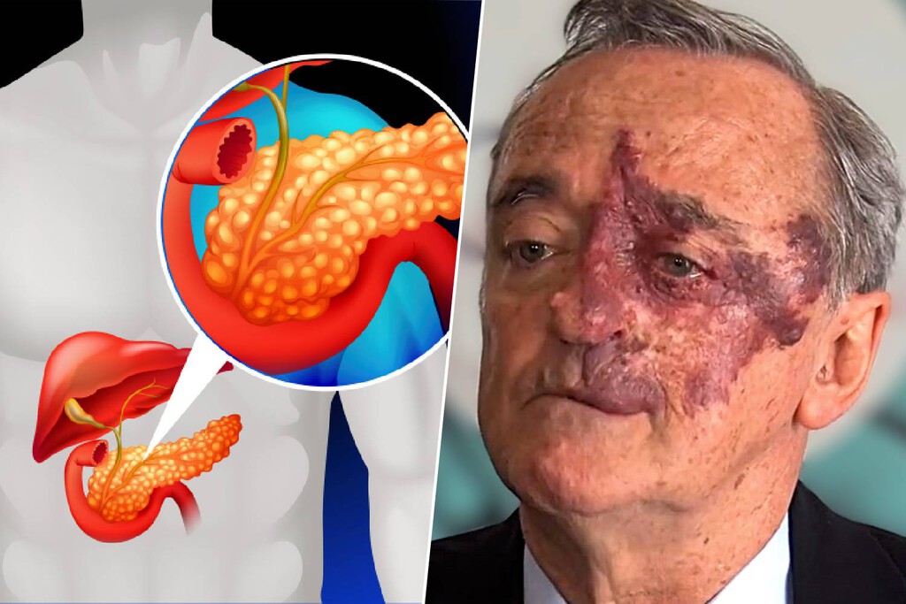 El prometedor estudio de Barbacid contra el cáncer ha sido retirado. El motivo no es la ciencia, es una spin-off “oculta”