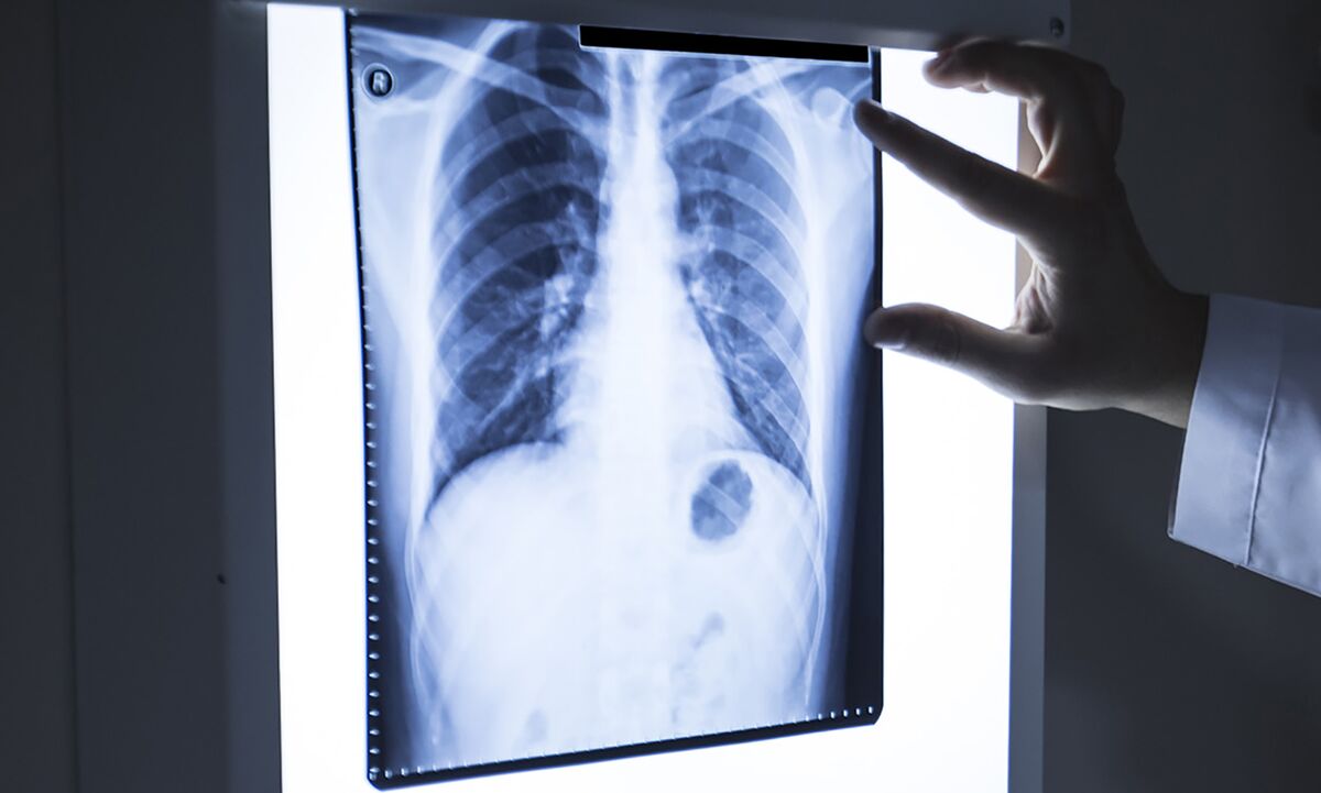 Novo-Backed Drugmaker Avalyn Raises $300 Million in Upsized IPO