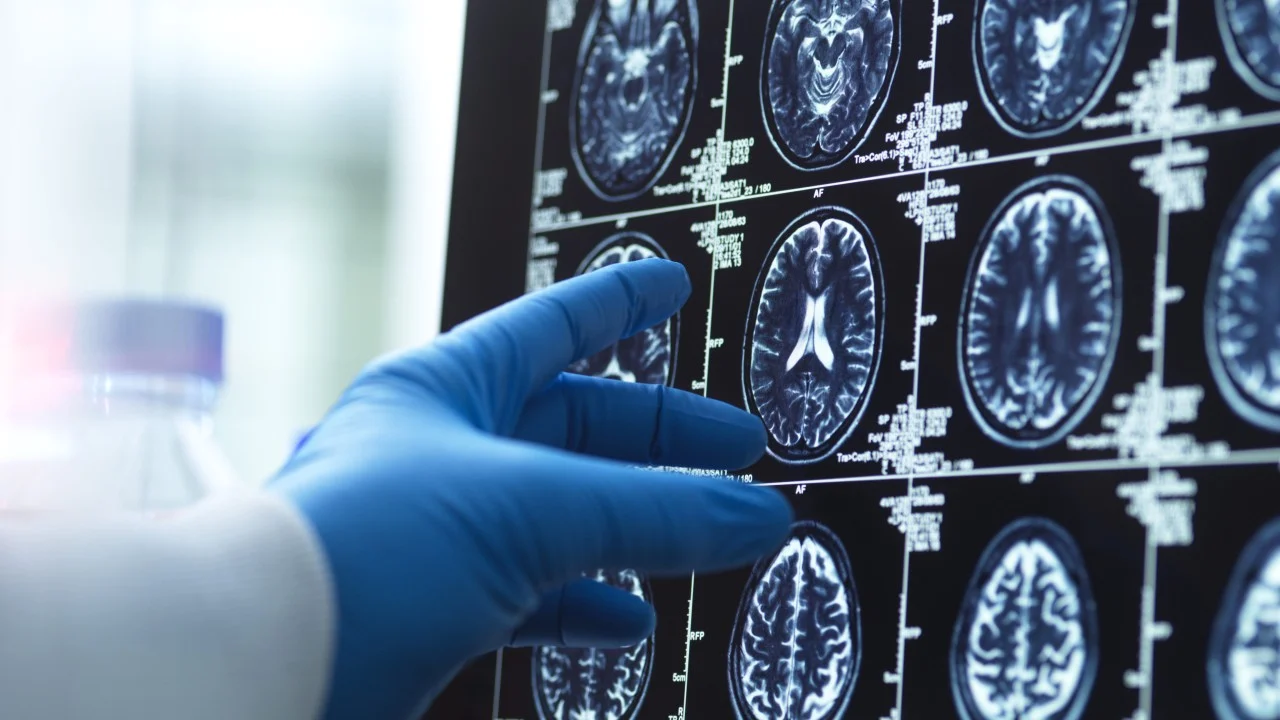 China launches war on Alzheimer’s that may affect 10% of population by 2050