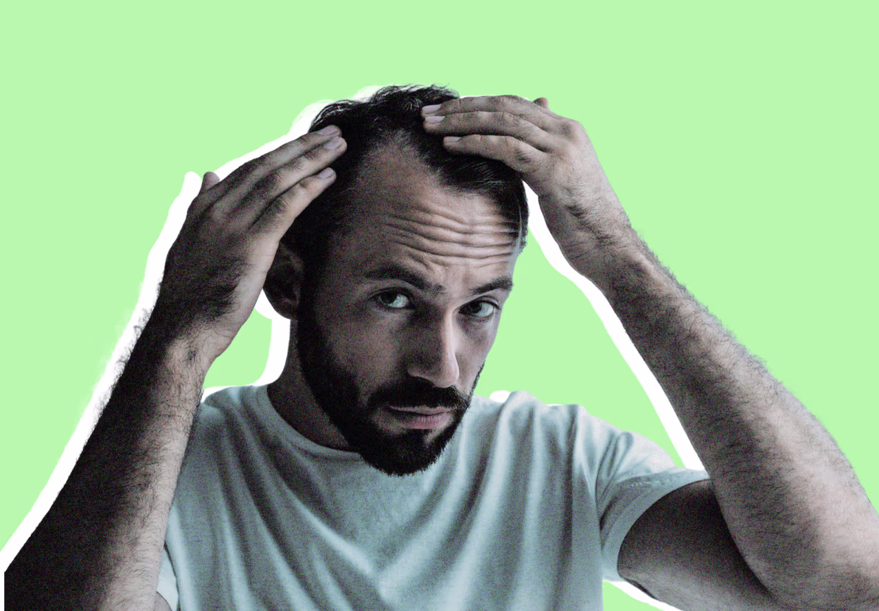 A new version of an old drug is helping men grow back some of their hair