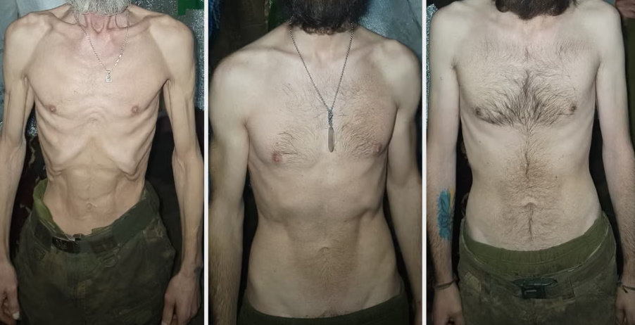 갈비뼈 앙상한 우크라 병사들…17일간 굶고 체중 40kg 줄기도